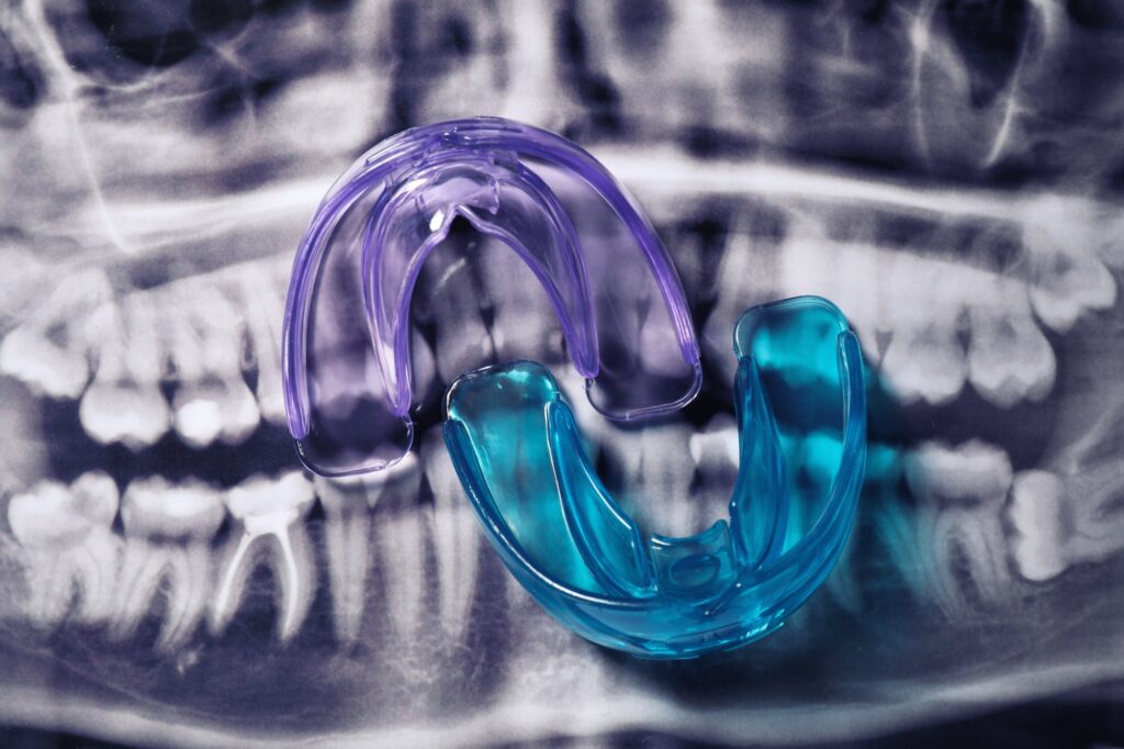 custom mouth guards, shown here laying on top of dental x-ray image, are key to help prevent sports-related dental injuries